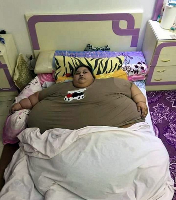 Η πιο παχύσαρκη γυναίκα στον κόσμο –Ετοιμάζεται να χειρουργηθεί για να επιβιώσει (Photo)