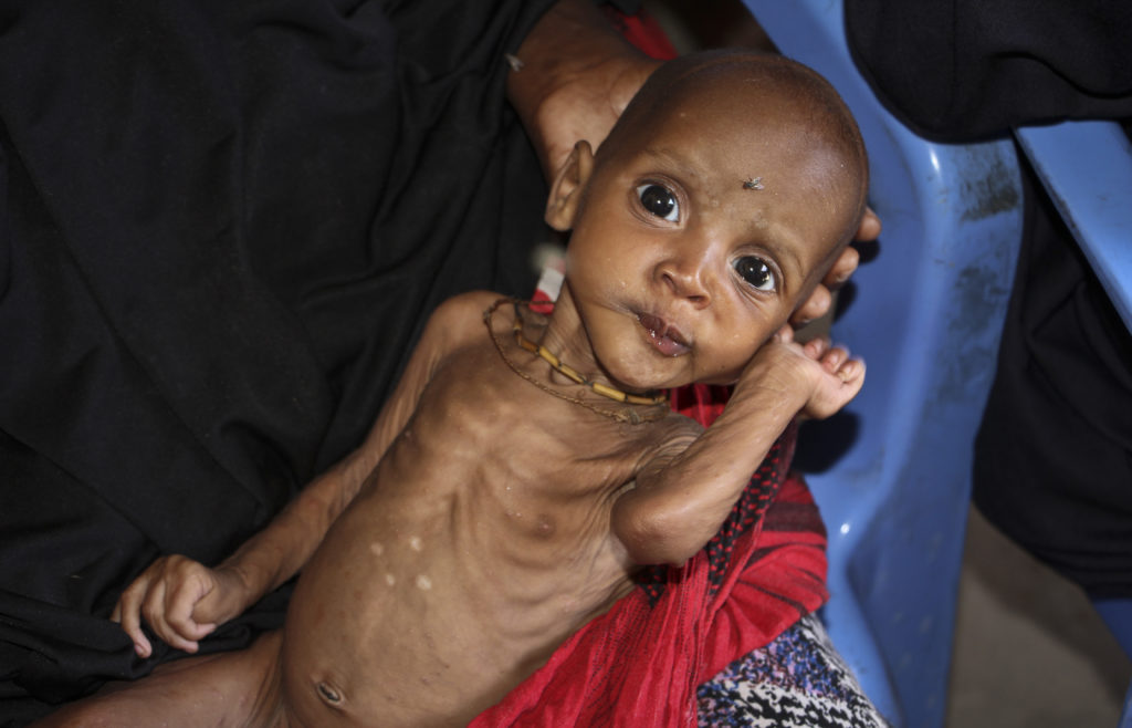 Γκουτέρες: «Να αποφευχθεί το χειρότερο» στη Σομαλία – Τι σημαίνει να πεθαίνεις από την πείνα
