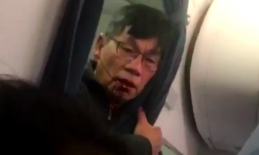 Εφιάλτης για την «εικόνα» της United Airlines το επεισόδιο με τον επιβάτη (Video)