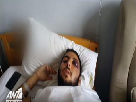 Πορτιέρης έσπασε το κεφάλι 17χρονου στο Γκάζι (Video)