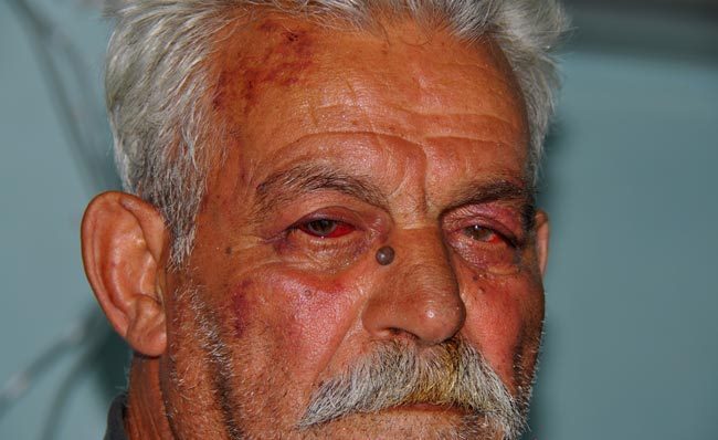 Σκουριές: Ο 77χρονος μπαρμπα-Θόδωρος καταδικάστηκε για αντίσταση κατά των ΜΑΤ