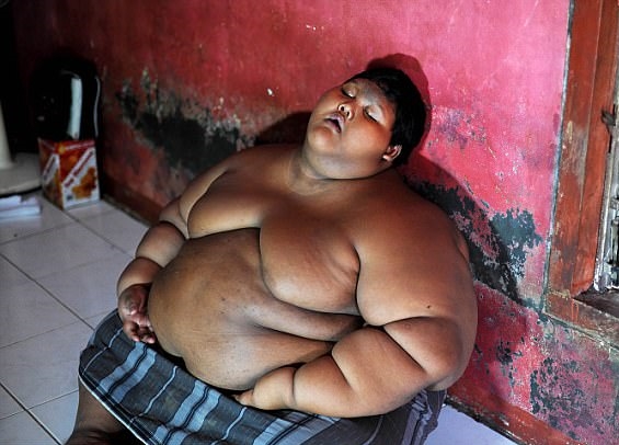 Αυτό είναι το πιο παχύσαρκο παιδί στον κόσμο – Οι γιατροί προσπαθούν να σώσουν τη ζωή του (Video & Photos)
