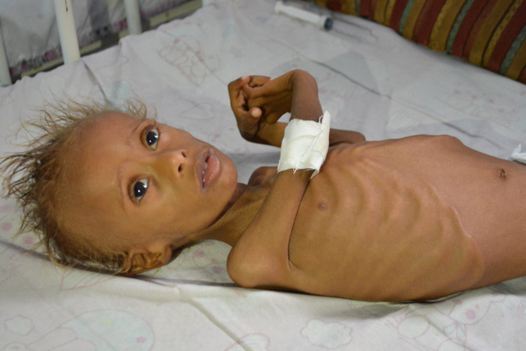 Ολική κατάρρευση στην Υεμένη: 22.000.000 άνθρωποι χρειάζονται ανθρωπιστική βοήθεια – Έγκλημα της Σαουδικής Αραβίας