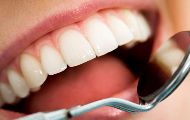 Πώς να αφαιρέσετε πλάκα και πέτρα από τα δόντια σας με φυσικό τρόπο