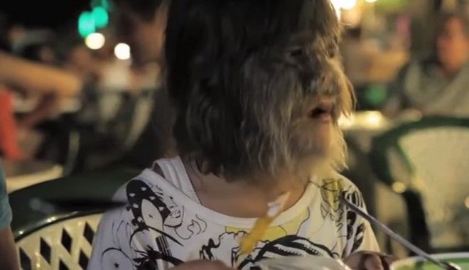 Το «πιο τριχωτό κορίτσι του κόσμου» έγινε αγνώριστο και παντρεύτηκε (Photos)