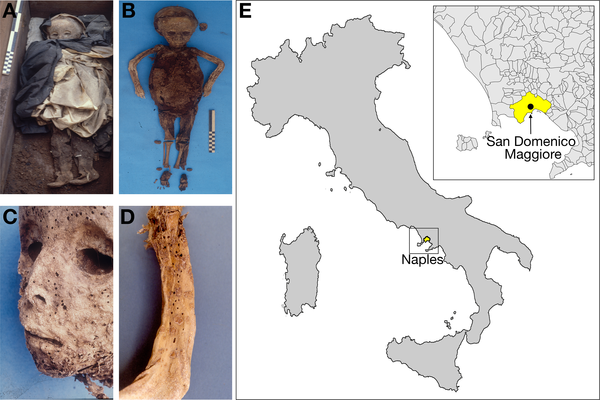 Ιταλία: Αρχαίο στέλεχος της ηπατίτιδας Β ανακάλυψαν επιστήμονες σε μούμια παιδιού του 16ου αιώνα