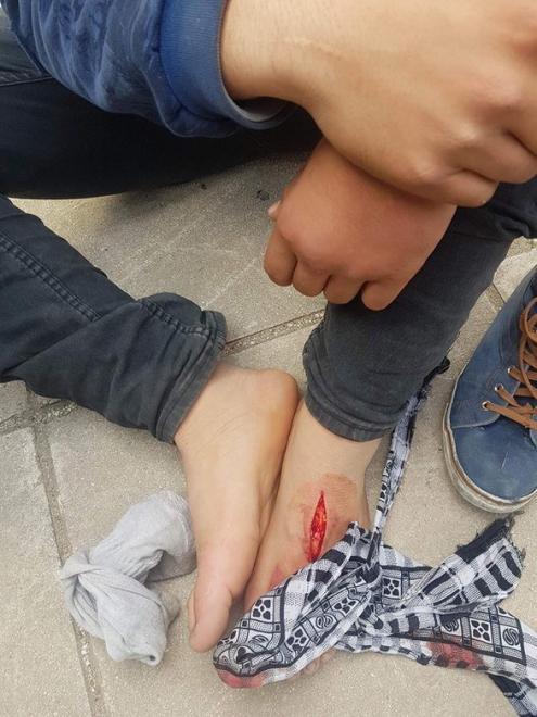 Νεολαία ΣΥΡΙΖΑ Πάτρας κατά του Λιμενικού για τον τραυματισμό 14χρονου Αφγανού