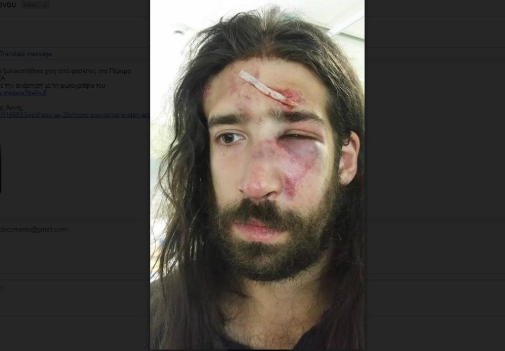 Πέραμα: Οργή για τη φασιστική επίθεση σε 28χρονο, μέλος της Νεολαίας ΣΥΡΙΖΑ