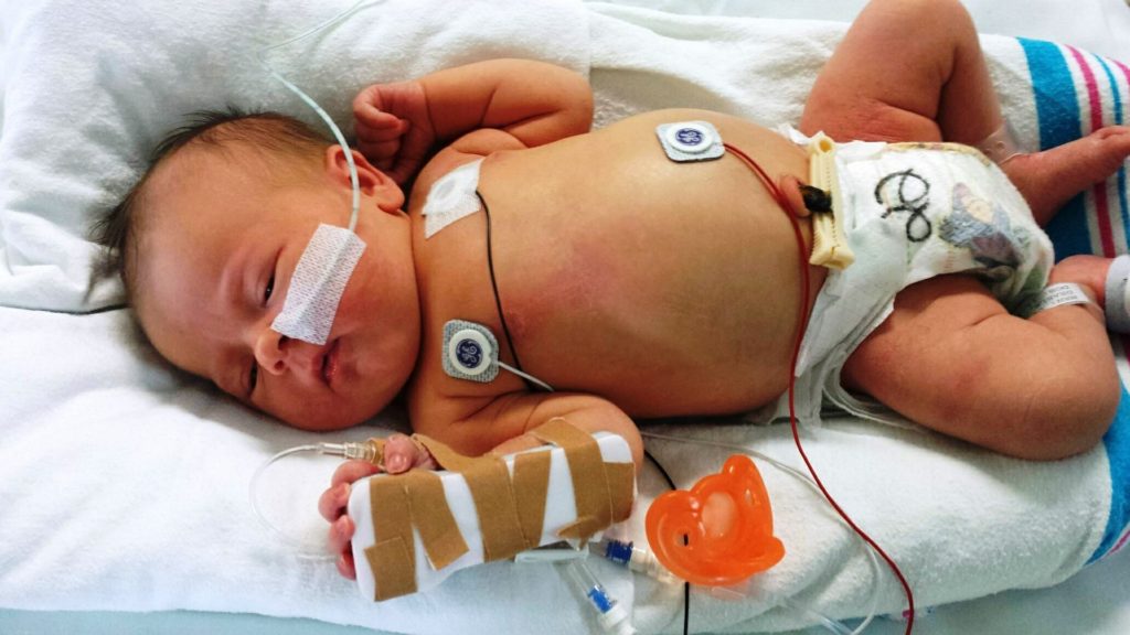 Νεκρά έξι νεογέννητα από σπάνιο βακτήριο στη Νότιο Αφρική