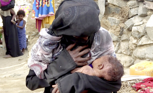 Υεμένη: Ένα εκατομμύριο παιδιά κινδυνεύουν να πεθάνουν από πείνα λόγω της αύξησης των τιμών βασικών αγαθών