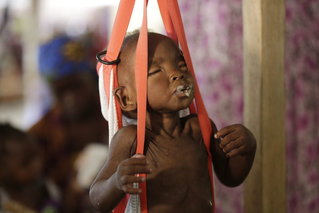 Αφρική: Ένα στα τρία παιδιά πεθαίνουν από την πείνα