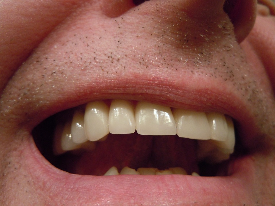 Προσοχή: Χαλασμένα δόντια μπορεί να οδηγήσουν σε υπέρταση – Τι δείχνει έρευνα για την περιοδοντίτιδα