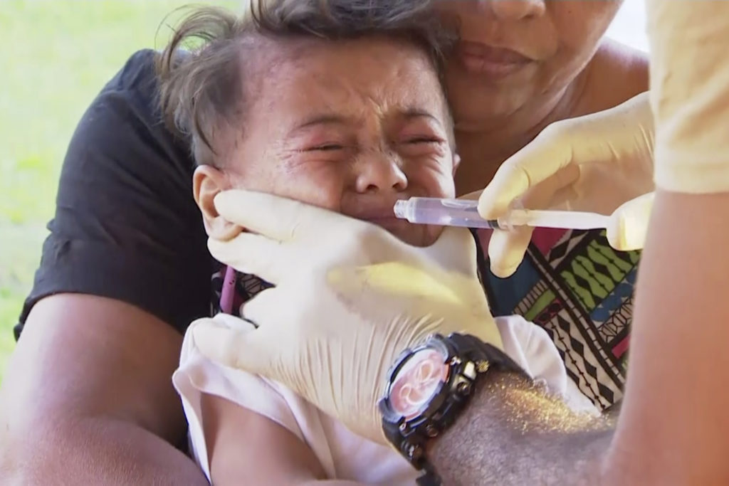 Σαμόα: Στους 79 οι νεκροί από ιλαρά – Δραματικό στραπάτσο για το «αντιεμβολιαστικό» κίνημα