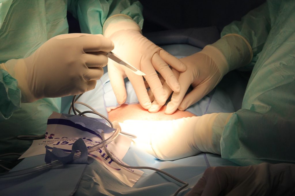 Ρουμανία: Ασθενής έπιασε φωτιά στη διάρκεια χειρουργικής επέμβασης