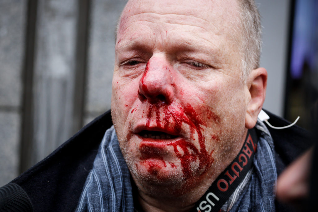 Άγρια επίθεση από ακροδεξιούς δέχθηκε φωτορεπόρτερ της Deutche Welle στο Σύνταγμα (Photos)