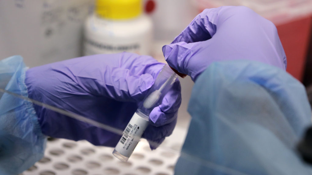 CDC: Ο κορονοϊός είναι πέντε φορές πιο φονικός από τη γρίπη για τους νοσηλευόμενους