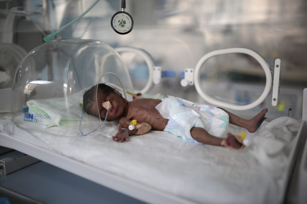Υεμένη: Ο γ.γ. του ΟΗΕ Αντόνιο Γκουτέρες προειδοποιεί για τον «επικείμενο κίνδυνο» λιμού
