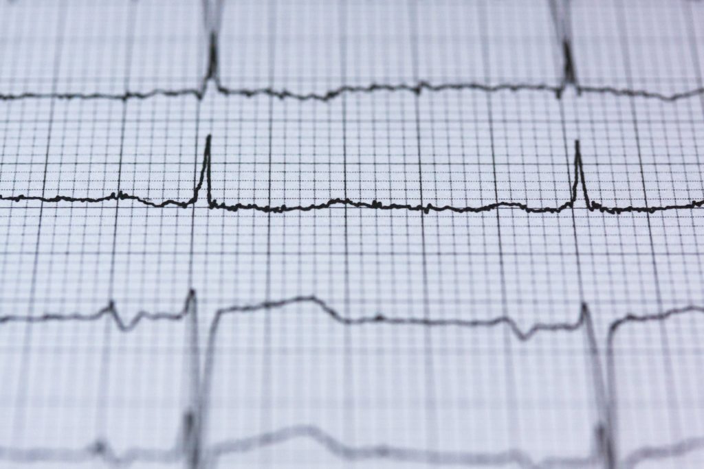 Άθληση και καρδιά: Τα σημαντικά οφέλη, ο πιθανός κίνδυνος και ο απαραίτητος προληπτικός καρδιολογικός έλεγχος