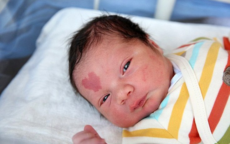 Τουρκία: Μωρό γεννήθηκε με το σχήμα της καρδιάς στο μέτωπο (Photos)