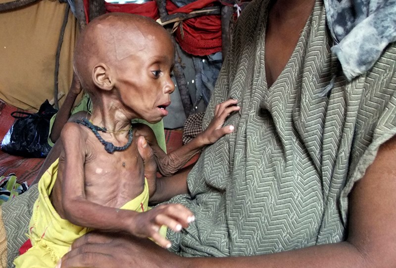 Δραματική έκκληση του ΟΗΕ: Πάνω από 20 εκ. άνθρωποι απειλούνται από λιμό