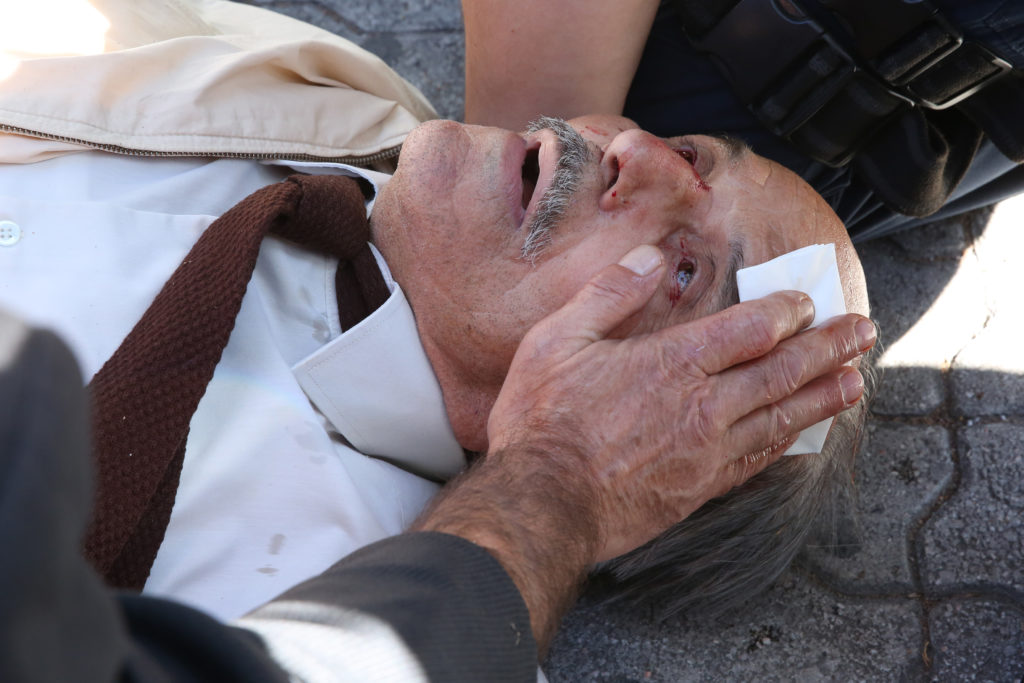 Άνδρας των ΜΑΤ γκρέμισε από σκάλα ηλικιωμένο –  Τραυματίστηκε σοβαρά στο κεφάλι (Photos)
