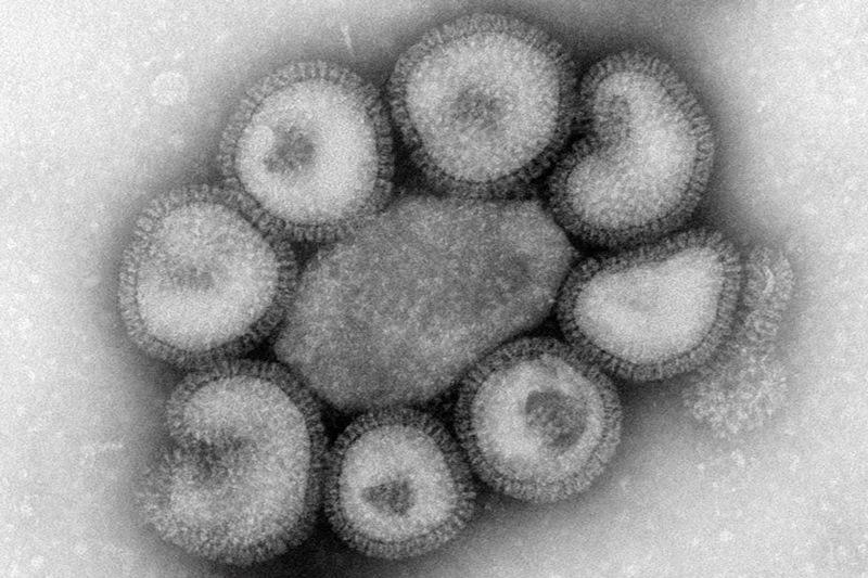 Αυστραλία: Με ραγδαίους ρυθμούς εξαπλώνεται ένας νέος «σαρκοφάγος» ιός