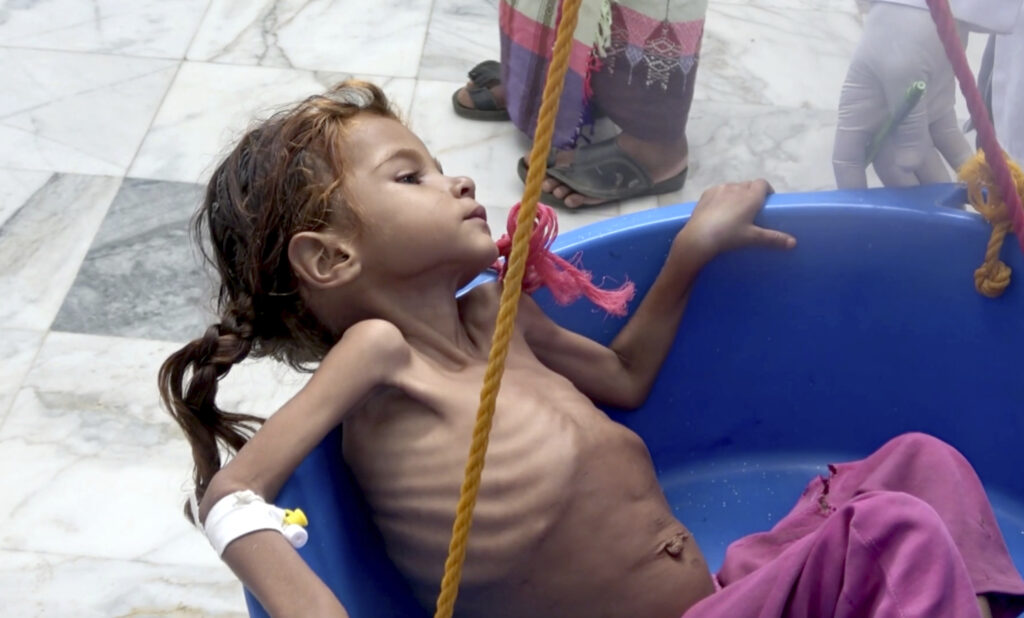 Υεμένη: Δεν αρκεί ο τερματισμός του πολέμου για να σωθούν τα παιδιά (Photos)
