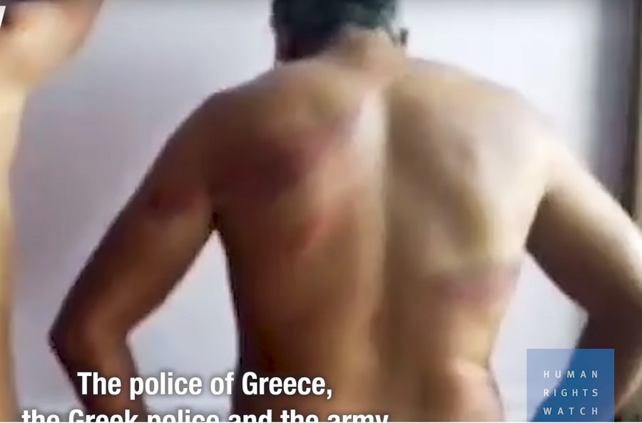 Καταγγελίες – «κεραυνοί» της Human Rights Watch – «Ξυλοδαρμοί μεταναστών από αστυνομικούς στον Έβρο» (Video)