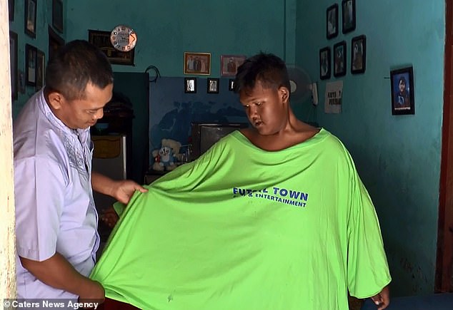Ινδία: Σοκαριστική αλλαγή 12χρονου που έχασε 90 κιλά σε ένα χρόνο