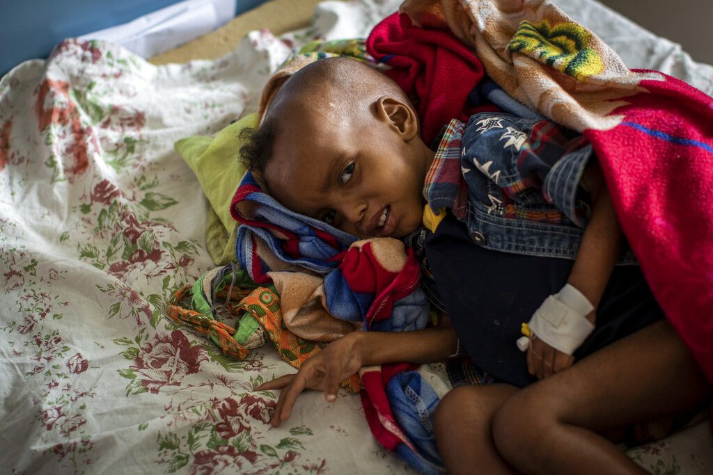Αιθιοπία: 100.000 παιδιά στο Τιγκράι κινδυνεύουν από ακραίo υποσιτισμό (UNICEF)