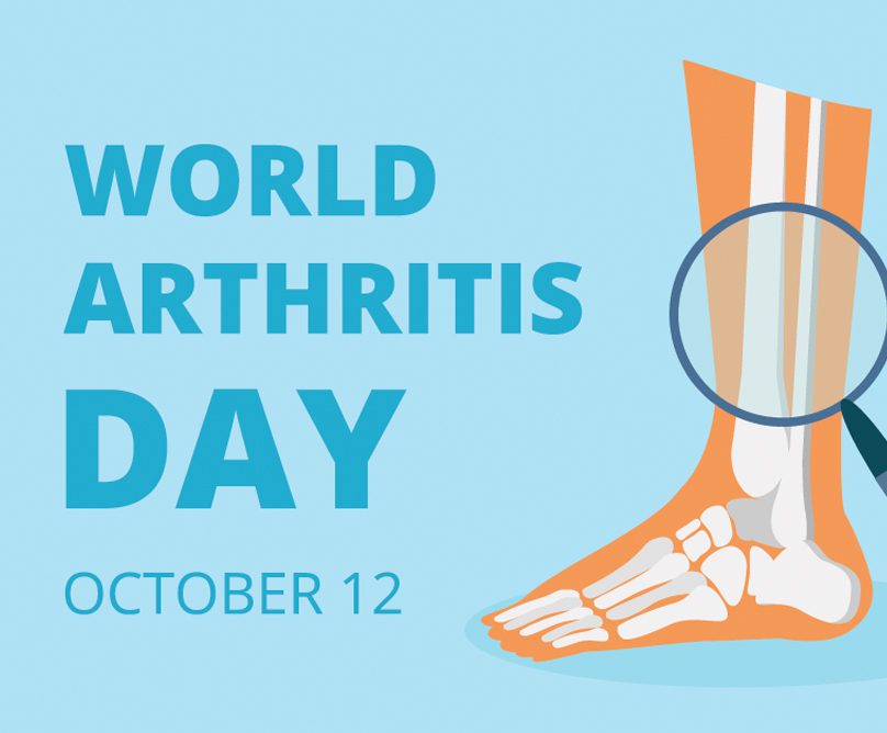 Μορφές αρθρίτιδας και σύγχρονες θεραπείες: 12 Οκτωβρίου – Παγκόσμια Ημέρα Αρθρίτιδας