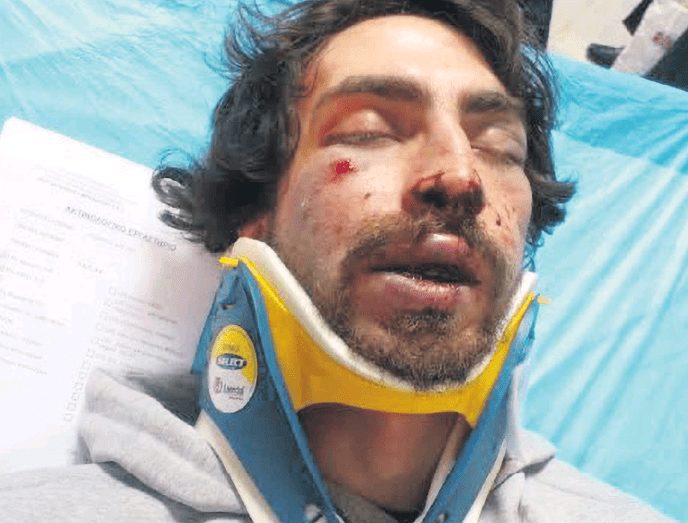 Δίκη για τον ξυλοδαρμό του φοιτητή Αλέξη Λάζαρη: Αρνείται τις κατηγορίες και αδειάζει τη Χρυσή Αυγή ο Ζέρβας