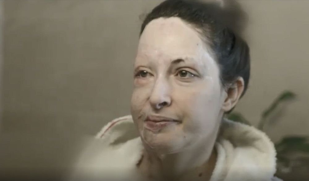 Μεγαλείο ψυχής από την Ιωάννα Παλιοσπύρου: Έδειξε το πρόσωπό της και επέστρεψε στο «σημείο μηδέν» (Video)