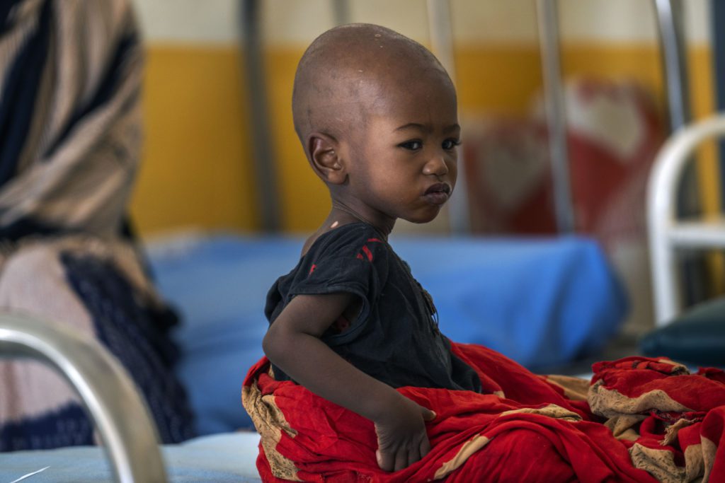 Unicef: Ένα παιδί κάθε λεπτό εισάγεται σε νοσοκομείο τη Σομαλίας λόγω υποσιτισμού