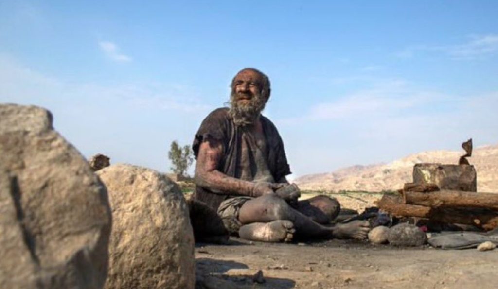 Ιράν: Πέθανε ο «πιο βρόμικος άνθρωπος του κόσμου» – Είχε να πλυθεί πάνω από 50 χρόνια (Video)