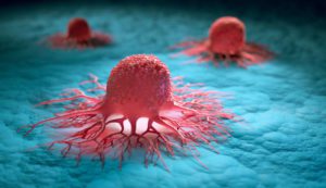 Καρκίνος του τραχήλου της μήτρας: Ενημέρωση για την αποτελεσματική πρόληψη έναντι της νόσου