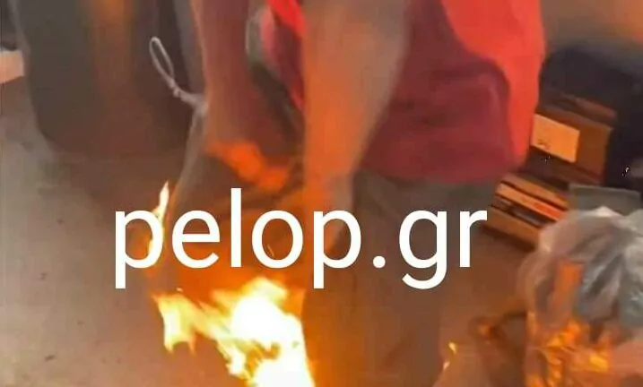 Σοκ στην Πάτρα: Ανάγκασαν 35χρονο να πει τα κάλαντα γονατιστός και του έβαλαν φωτιά (Σκληρές εικόνες)