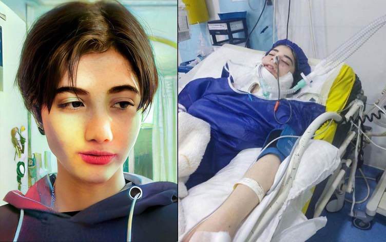 Ιράν: Νέα υπόθεση «Αμινί» – Εγκεφαλικά νεκρή έφηβη θύμα της «αστυνομίας ηθών»