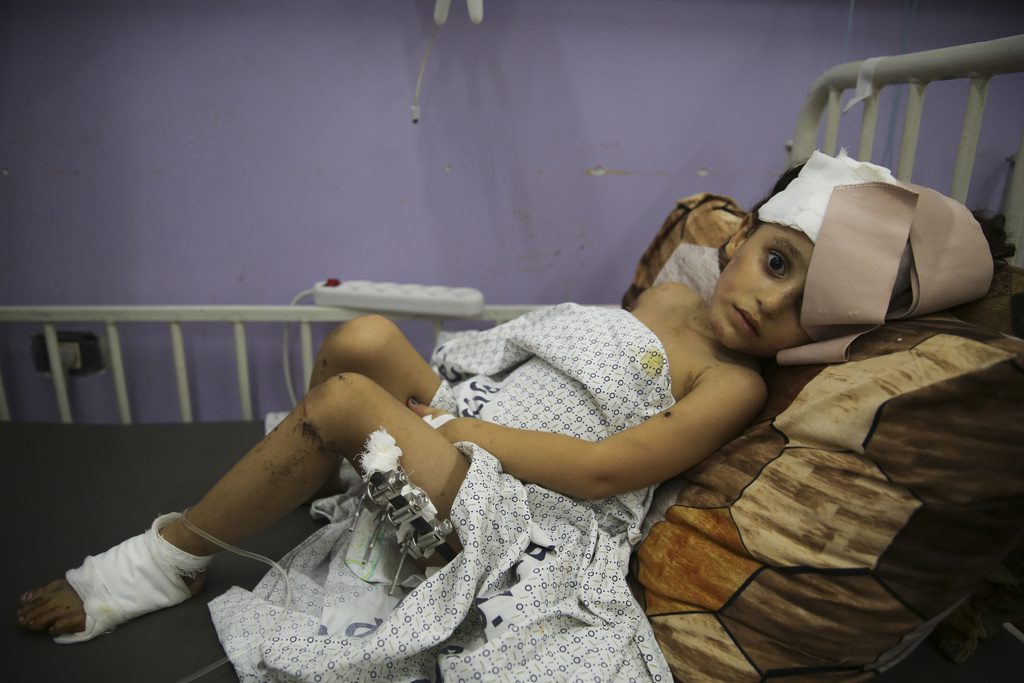 ΠΟΥ: Εξαντλημένοι από την πείνα οι ασθενείς στα νοσοκομεία της Γάζας