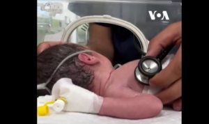 Γάζα: Πέθανε το μωρό που γεννήθηκε με καισαρική από τη νεκρή μητέρα του