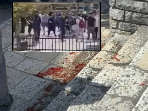 Κέρκυρα: Σοκαριστικό βίντεο λίγο πριν την αιματηρή συμπλοκή – Νεαροί χτυπούν με κλωτσιές ανήλικο