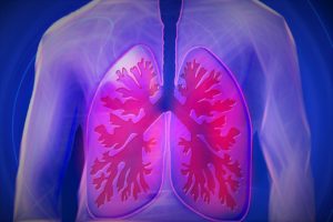 Καρκίνος πνεύμονα: αντιμετώπιση με Θωρακοσκοπική Χειρουργική VATS