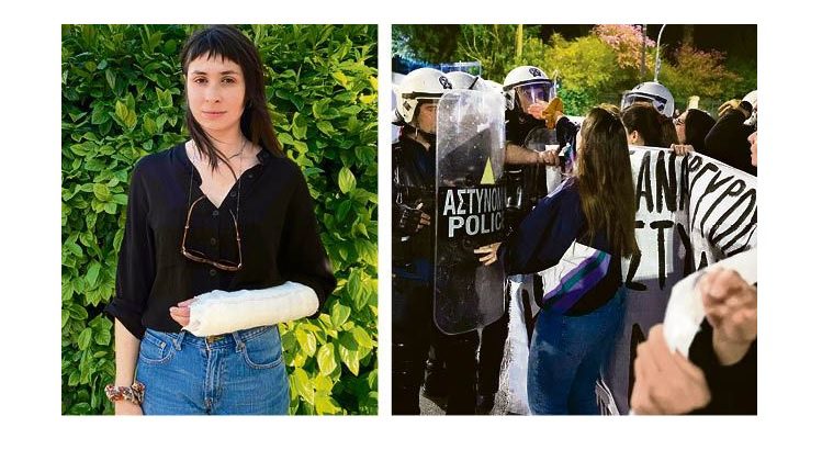 Αστυνομική βία: «Θα κυνηγήσω το δίκιο μου» – Καταγγέλλει στο Documento η 28χρονη – θύμα του αστυνομικού που της έσπασε το χέρι