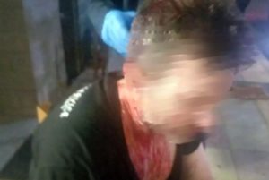 Αγρίνιο: «Μου άνοιξαν το κεφάλι σε δύο σημεία, έχω 12 ράμματα», λέει ο εστιάτορας που ξυλοκοπήθηκε από πελάτες (Video)