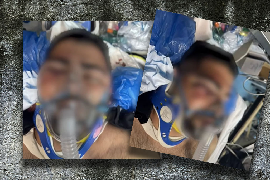 Μοτοσικλετιστής καταγγέλλει τον ξυλοδαρμό του από άνδρες της ΔΙΑΣ – «Τον χτύπησαν με τον ασύρματο» (Video)