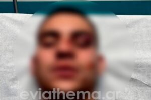 Χαλκίδα: 18χρονος έστειλε στο νοσοκομείο 19χρονο επειδή έκανε like στη σύντροφό του